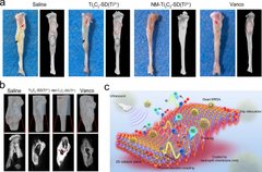 2D ultrasound-responsive antibacterial nano-sheets to effectively address bone tissue infection